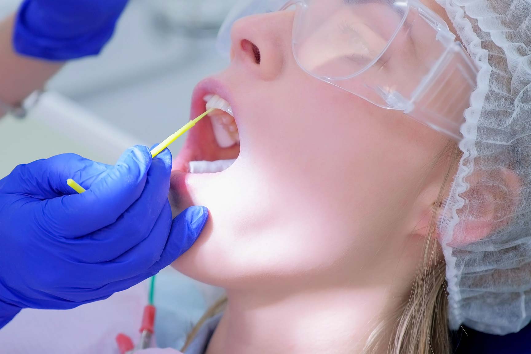 Fluoride varnish application